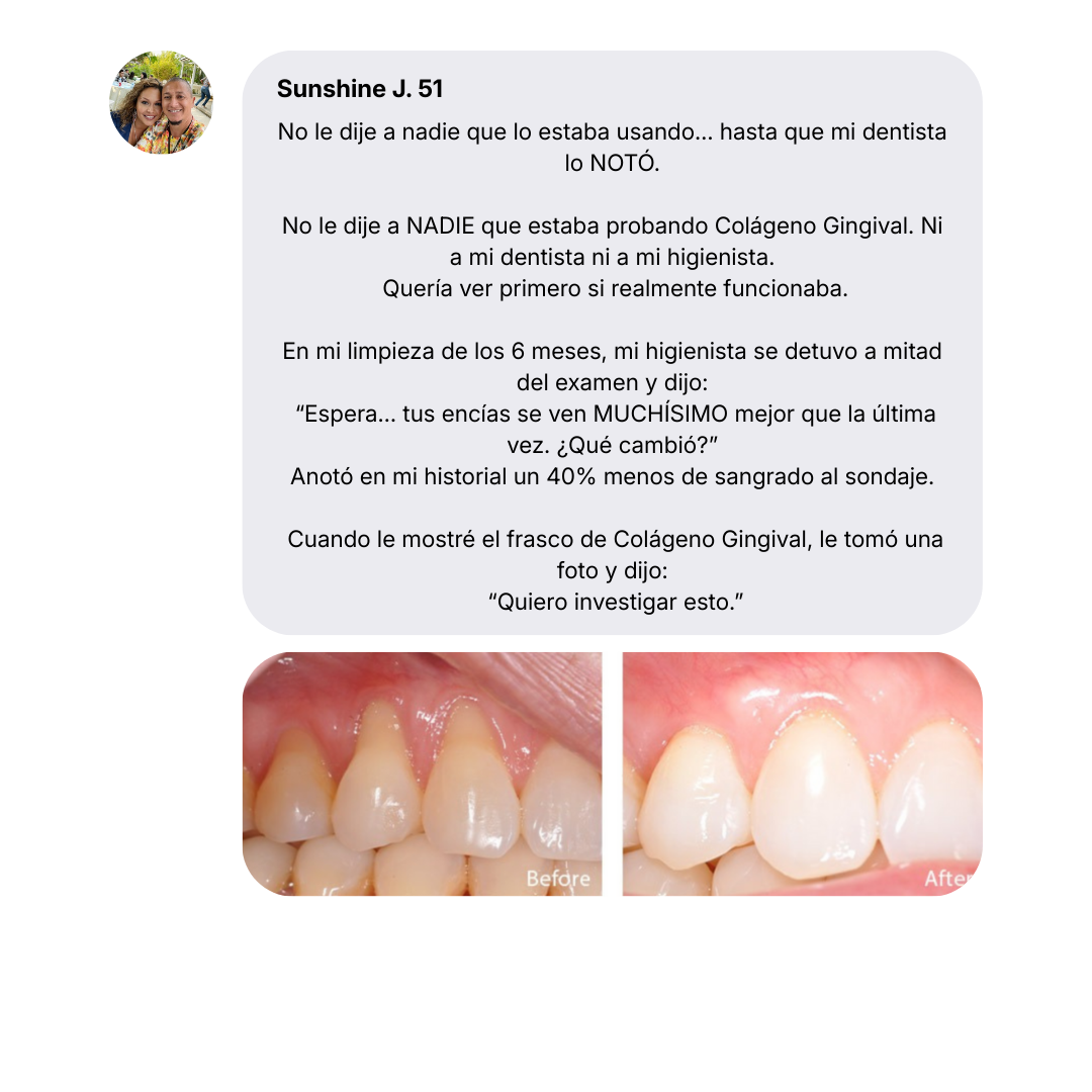 Colágeno Gingival