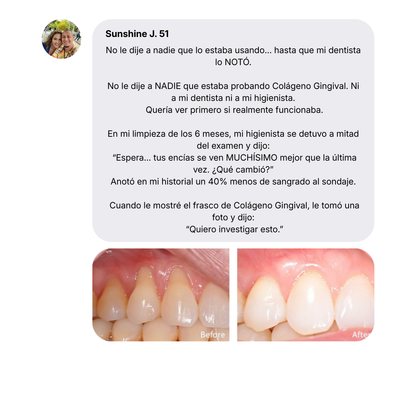 Colágeno Gingival