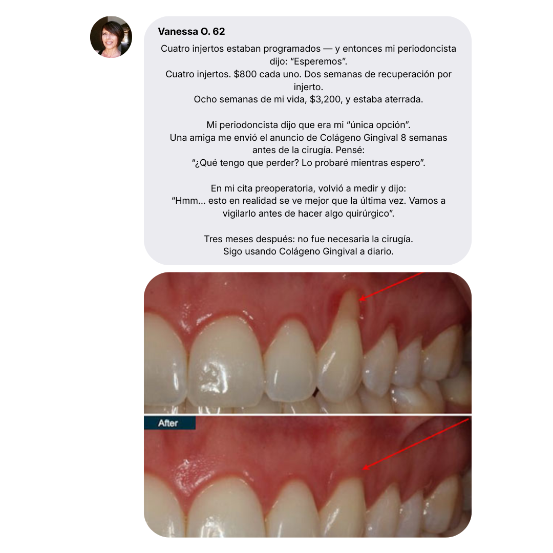 Colágeno Gingival